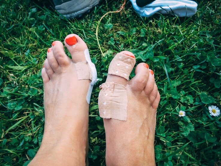 Zwei nackte Füße mit rotem Nagellack und Pflastern an den Zehen liegen auf grünem Rasen neben einem Schuh.